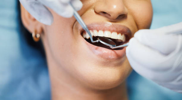 Best Emergency Dentist for Lost Fillings or Crowns in Bismarck, ND