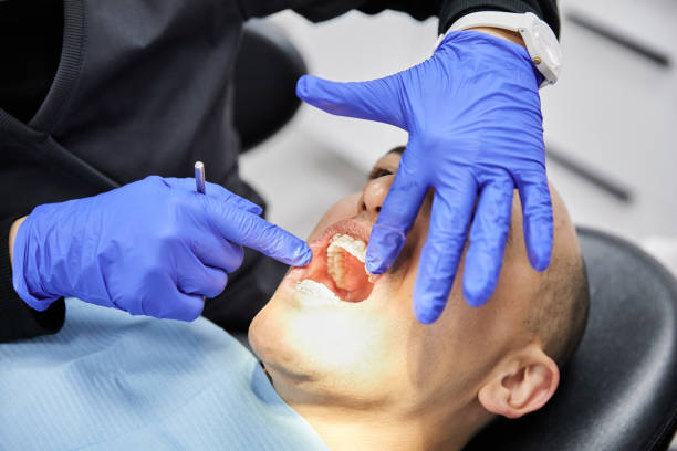Best Emergency Dentist for Knocked-Out Tooth in Bismarck, ND